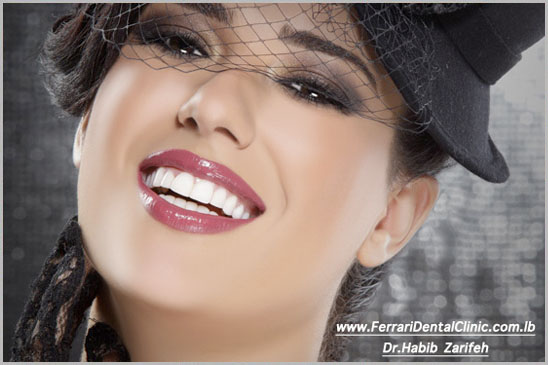 Hollywood Smile Cosmetic Dentistry beirut lebanon