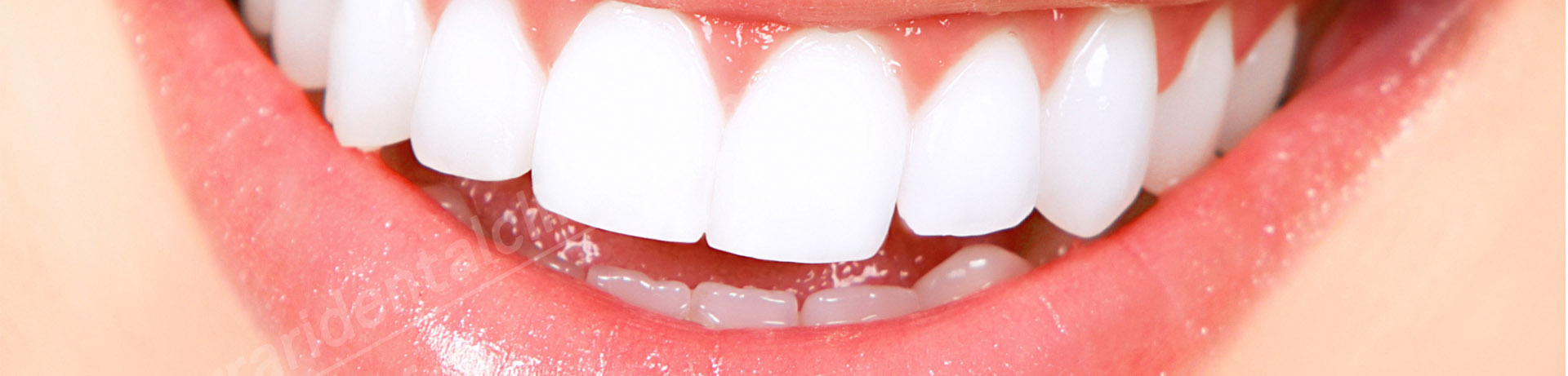 Hollywood Smile beirut lebanon