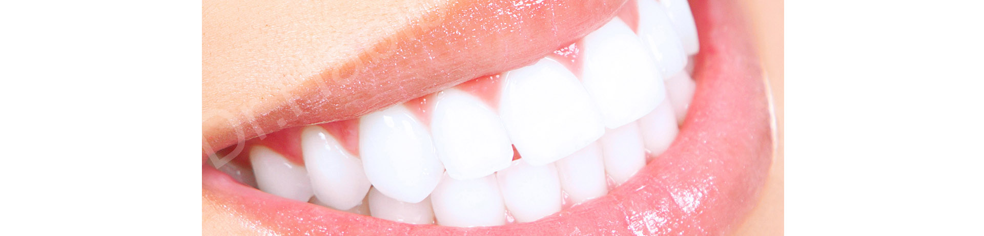 Hollywood Smile beirut lebanon