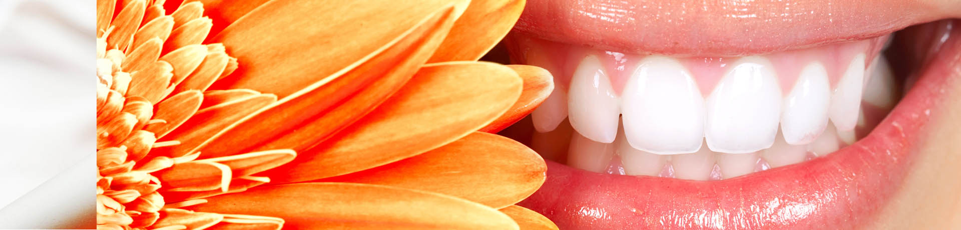 Hollywood Smile beirut lebanon