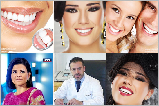 Hollywood Smile beirut lebanon